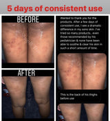 Shea butter moisturizer